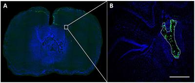 In-vivo time course of organ uptake and blood-brain-barrier permeation of poly(L-lactide) and poly(perfluorodecyl acrylate) nanoparticles with different surface properties in unharmed and brain-traumatized rats